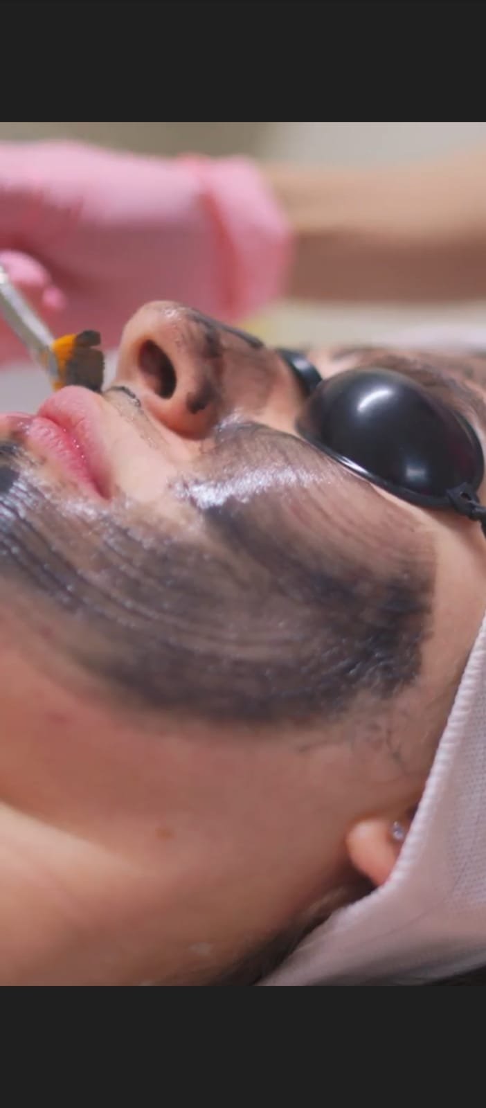 Hollywood Peel