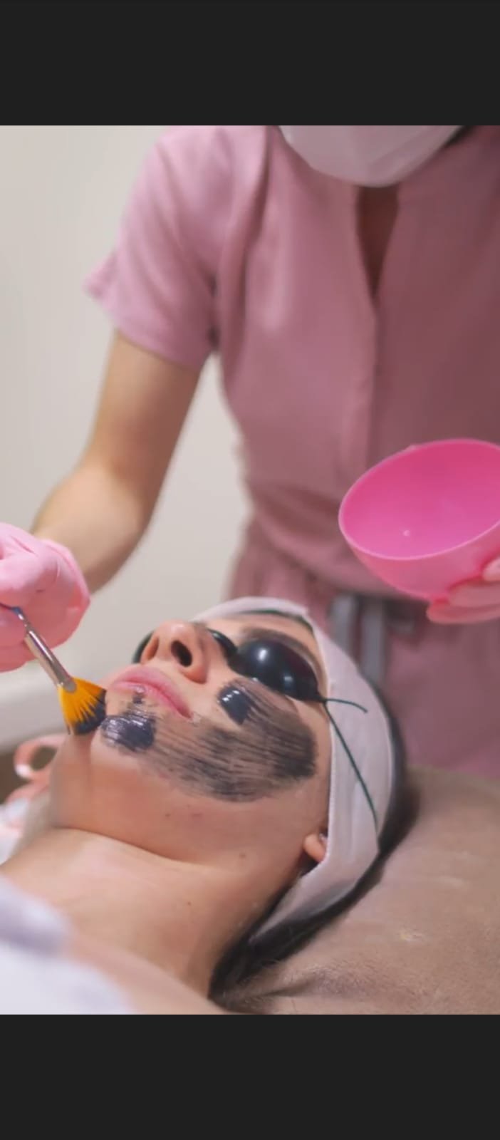 Hollywood Peel