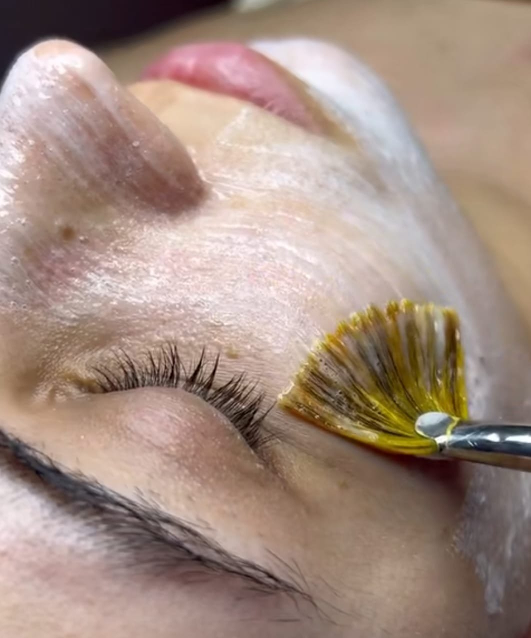 Lifting Facial